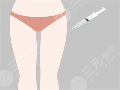 大腿部吸脂减肥果前后对比图 大腿部吸脂手术恢复全过程