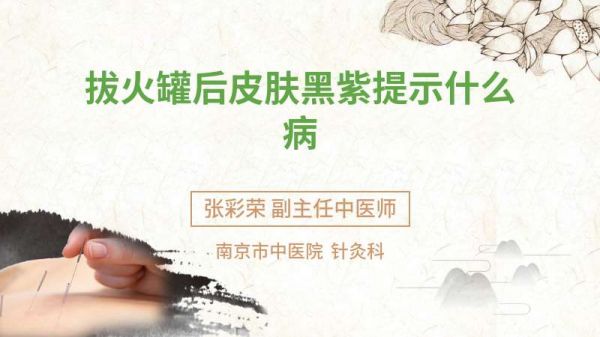 拔火罐后皮膚黑紫提示什么病
