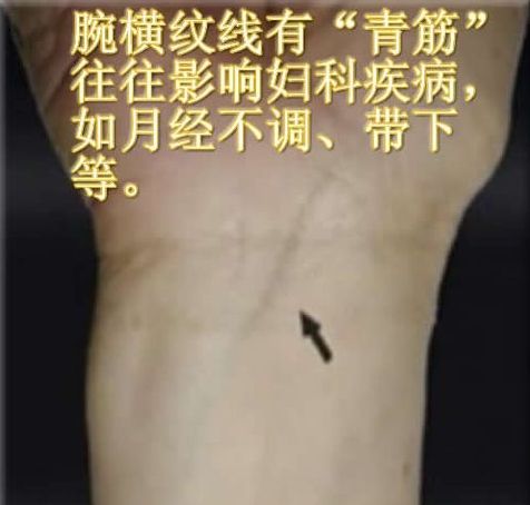 [轉(zhuǎn)載]青筋診法全集
