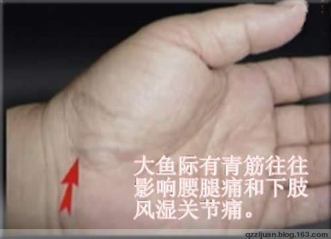 [轉(zhuǎn)載]青筋診法全集