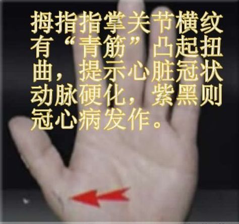 [轉(zhuǎn)載]青筋診法全集