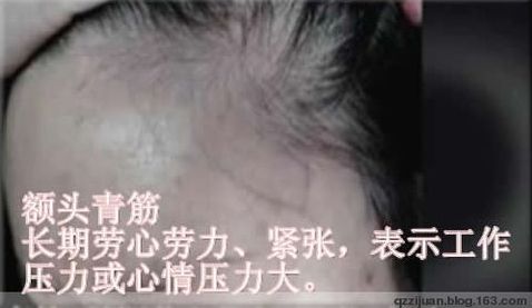 [轉(zhuǎn)載]青筋診法全集
