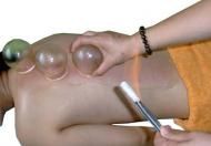 中醫(yī)拔罐養(yǎng)生中最常見的九大穴位