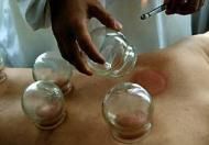 介紹拔罐養(yǎng)生常用穴位