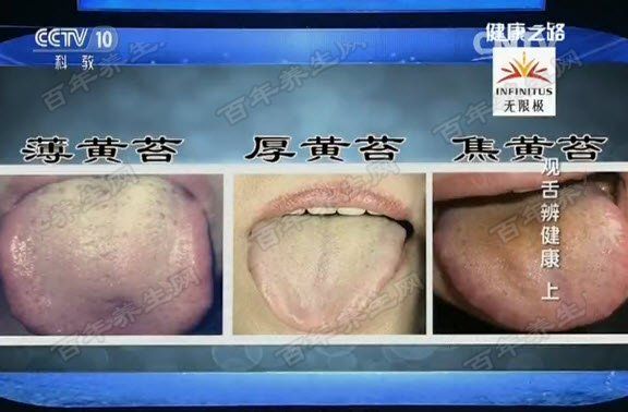 黄苔