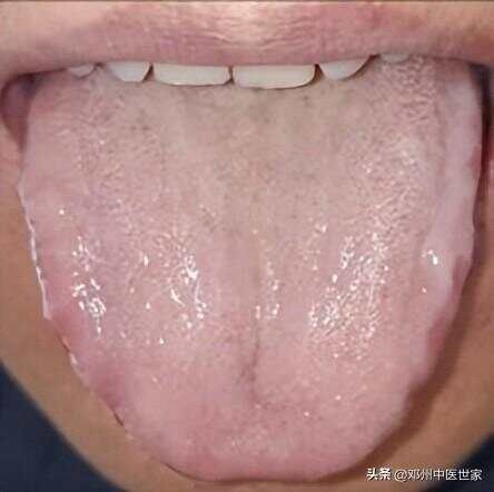 文章圖片2