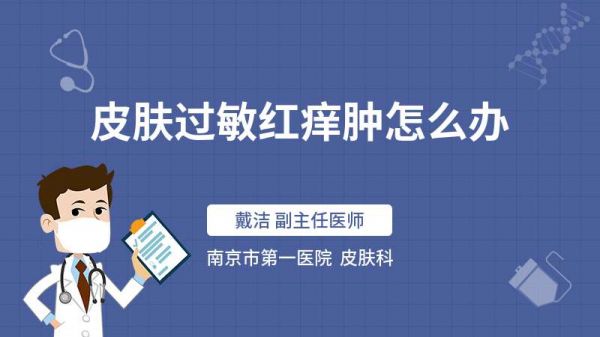 皮肤过敏红痒肿怎么办
