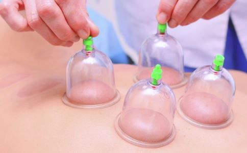 酒精拔罐被燒傷 拔罐如何避免被燒傷 拔罐要注意什么