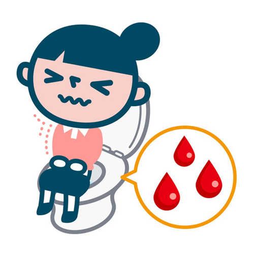 埋線減肥月經(jīng)要注意什么