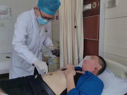 減肥福音！脂肪肝肥胖癥的綠色療法——針灸穴位埋線