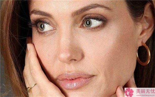 果酸嫩肤过后怎么样恰当的养护？