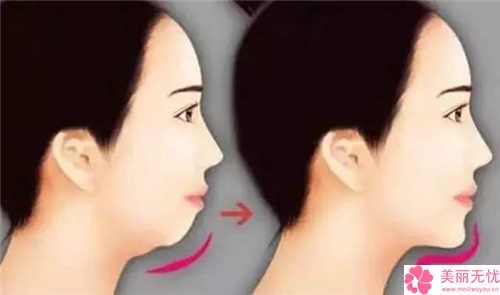 平?jīng)鍪邢掳臀瑑?yōu)勢醫(yī)院排行榜top10名氣榜單推薦（平?jīng)鍪邢掳臀瑑?yōu)勢整形醫(yī)院）