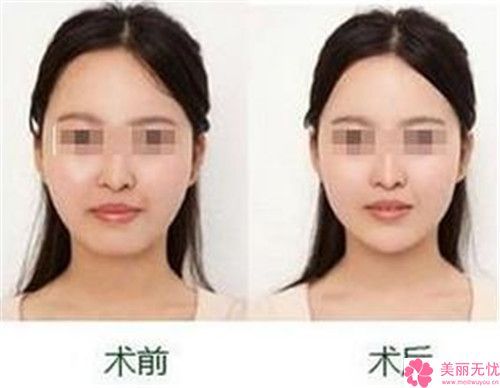 平?jīng)鍪邢掳臀瑑?yōu)勢醫(yī)院排行榜top10名氣榜單推薦（平?jīng)鍪邢掳臀瑑?yōu)勢整形醫(yī)院）