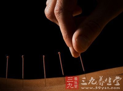 針灸減肥的基本介紹