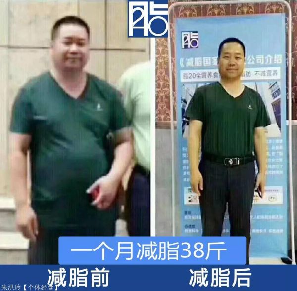 当下健康减脂产品脂20真的那么好 脂20代理利润如何