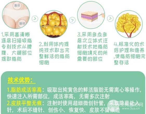 北京东方和谐王自谦填充价格表