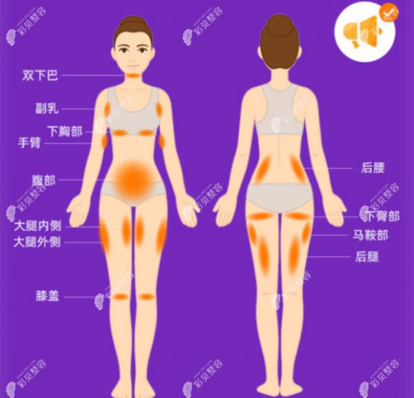 酷塑冷凍溶脂價(jià)格比儀器抽脂更便宜嗎