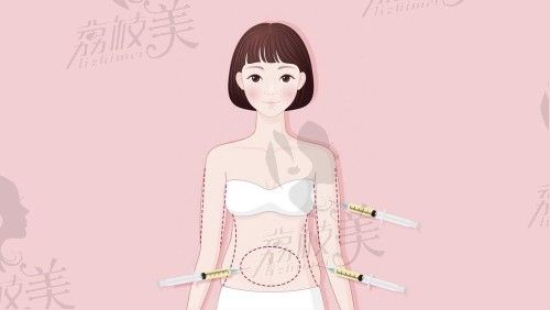 杭州吸脂價(jià)格表