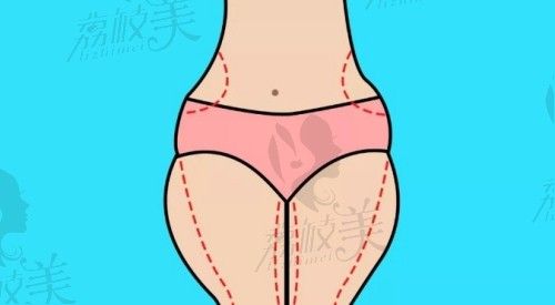 杭州藝星醫(yī)療美容醫(yī)院吸脂價(jià)格表