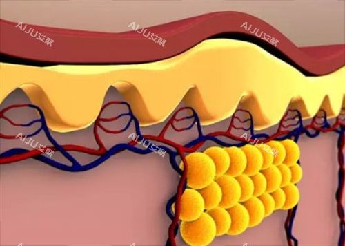 脂肪在皮下的展示图