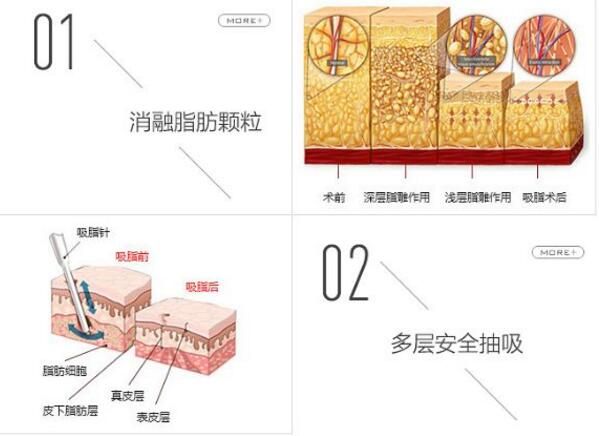 男人肚子吸脂肪多少錢？腹部抽脂價(jià)格表匯總，3家正規(guī)醫(yī)院可選！