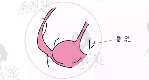 抽脂費(fèi)用抽脂價(jià)格一覽表