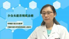 少白头能否彻底治愈