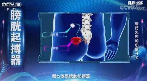 管好失控的小便開關(guān) “3個(gè)3”訓(xùn)練幫您緩解尿失禁