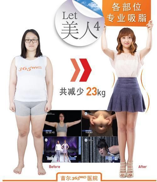 金真女士瘦身對(duì)比照片