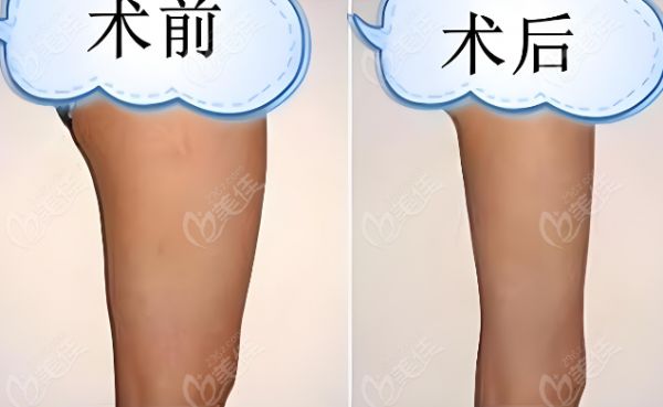 對(duì)比照片