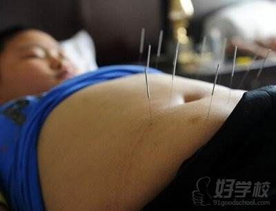 中醫(yī)減肥