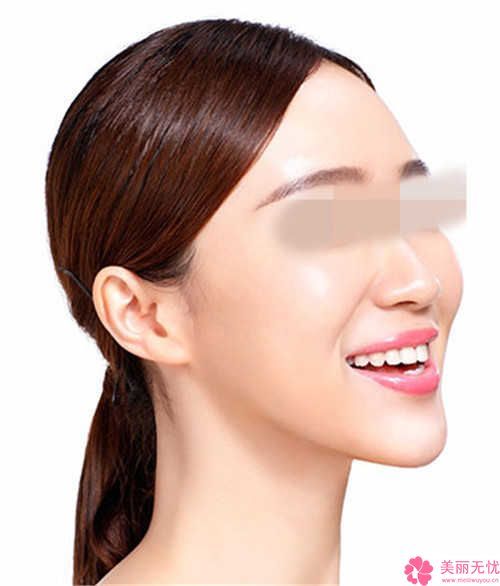 廣州名韓醫(yī)療美容醫(yī)院超聲刀面部抽脂術(shù)后護(hù)理及恢復(fù)時(shí)間