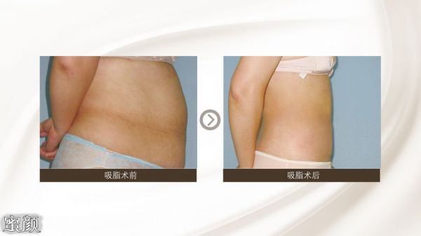 https://img.miyanlife.com/mnt/Editor/2020-06-27/5ef73410d3a3b.jpg