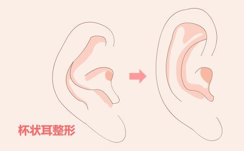 超音波整形技術(shù) 超音波抽脂手術(shù) 超音波手術(shù)