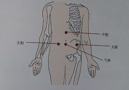 针灸减肥的取穴及其操作方法