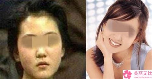 绍兴市下颌斜导矫正器医院在榜清单前十位重磅盘点（绍兴市下颌斜导矫正器整形医院）
