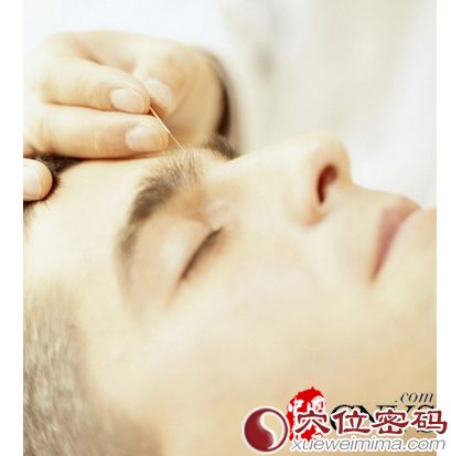 需遵守三個原則 針灸亦可美容