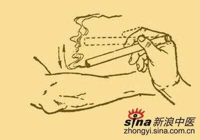 艾灸減肥助你脂肪燃起來！