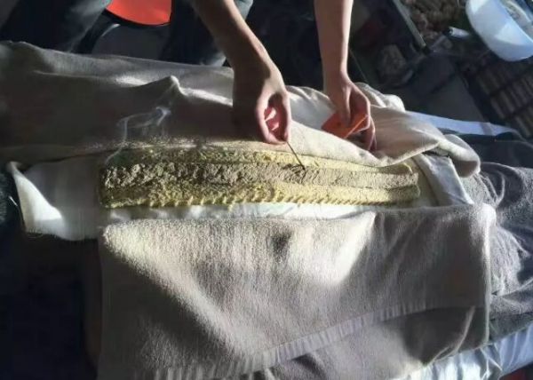 督脈灸能起到保健養(yǎng)生作用