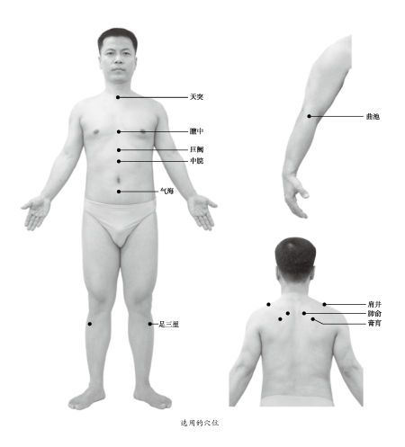 咳嗽九個(gè)艾灸特效穴位