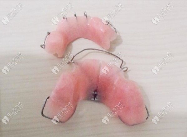 twinblock矯治器的原理