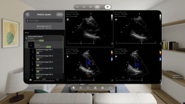 Apple-Vision-Pro-health-apps-Visage-Ease-VP