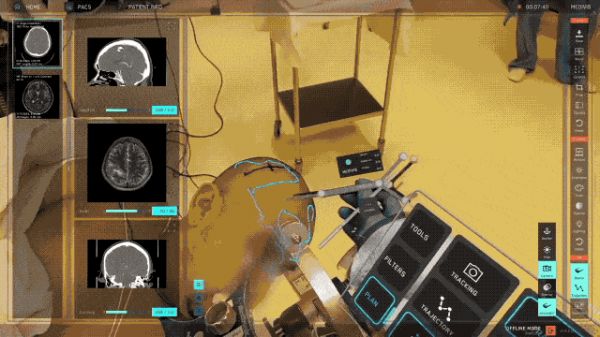 Real-time_3D_surgery_with_Apple_Vision_Pro-2