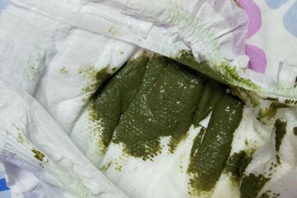 綠色糊狀大便圖