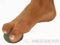 足底筋膜炎運(yùn)動(dòng)康復(fù)方法