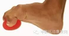 足底筋膜炎運(yùn)動(dòng)康復(fù)方法