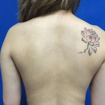 重慶光博士醫(yī)療美容怎么樣？醫(yī)生推薦及真人吸脂瘦腿案例分享