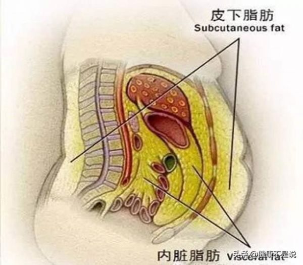 你肚子肥肉多吗，不用运动就可以清除内脏脂肪