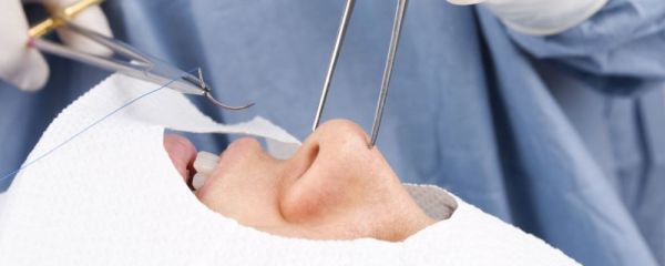 微整形的项目 微整形方法 流行的微整形方法