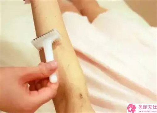 背部做吸脂瘦背对身体的伤害有多大